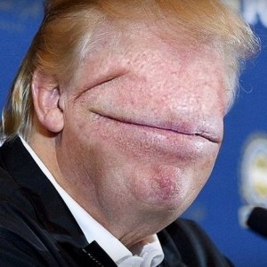 Trump mouth